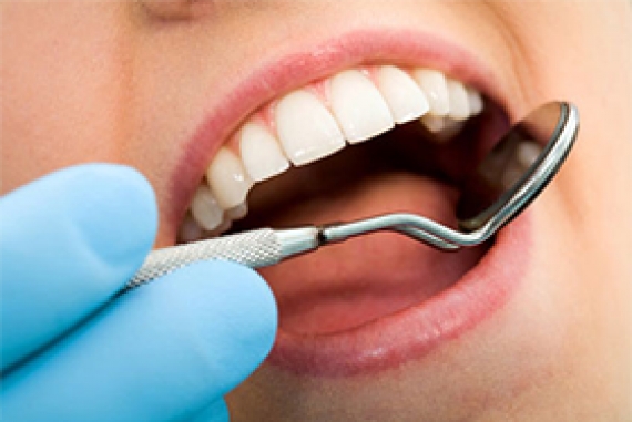 Dental Scaling / Prophylaxis / Cleaning